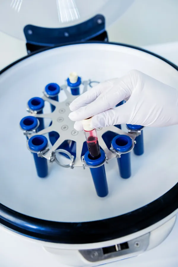 Iron-Metabolism-Testing-Treatment A blood centrifuge. Get Iron Metabolism testing from Morgan Burns, APRN in Central Florida.