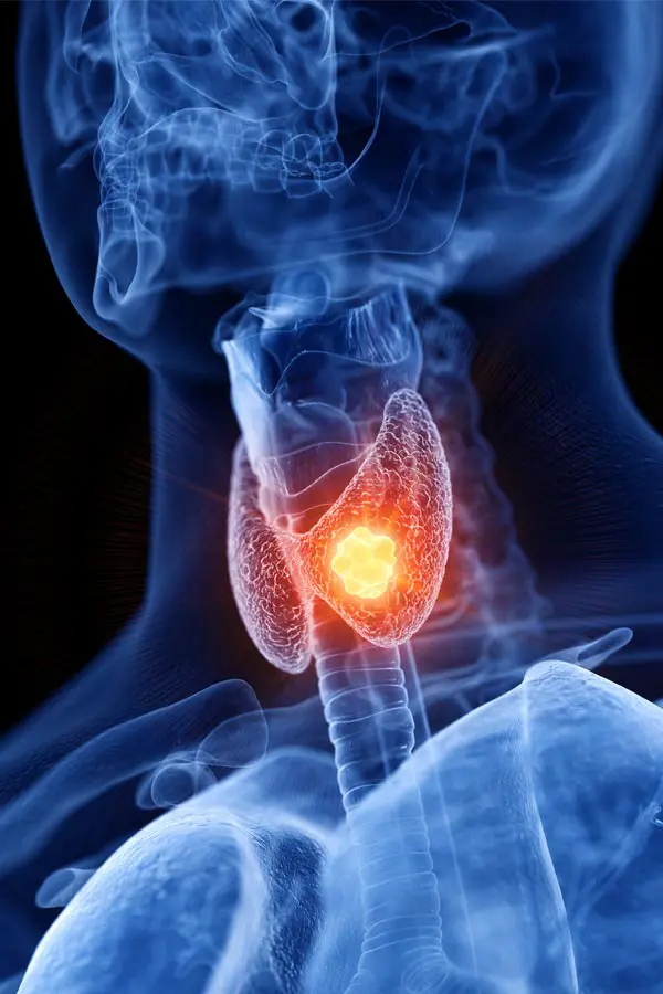 Thyroid-Imbalance-Treatment A 3D illustration of an x-ray of a human neck, highlighting the thyroid. Get help with thyroid imbalance from Morgan Burns, APRN in Central Florida.